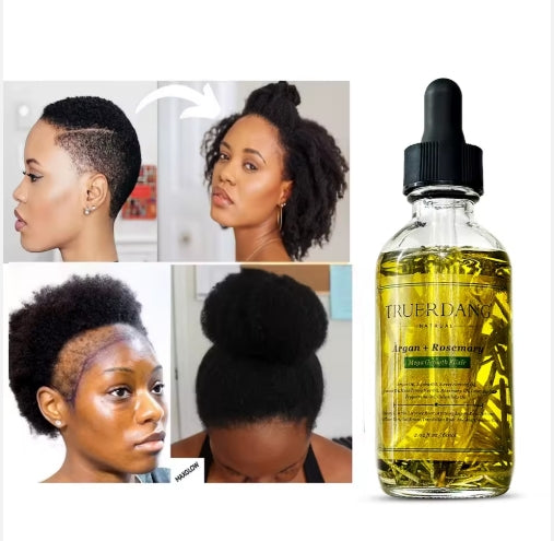 Organic Natural Elixir Herbal Scalp Care Hair Loss Regrowth Treatment Hair Growth Oil