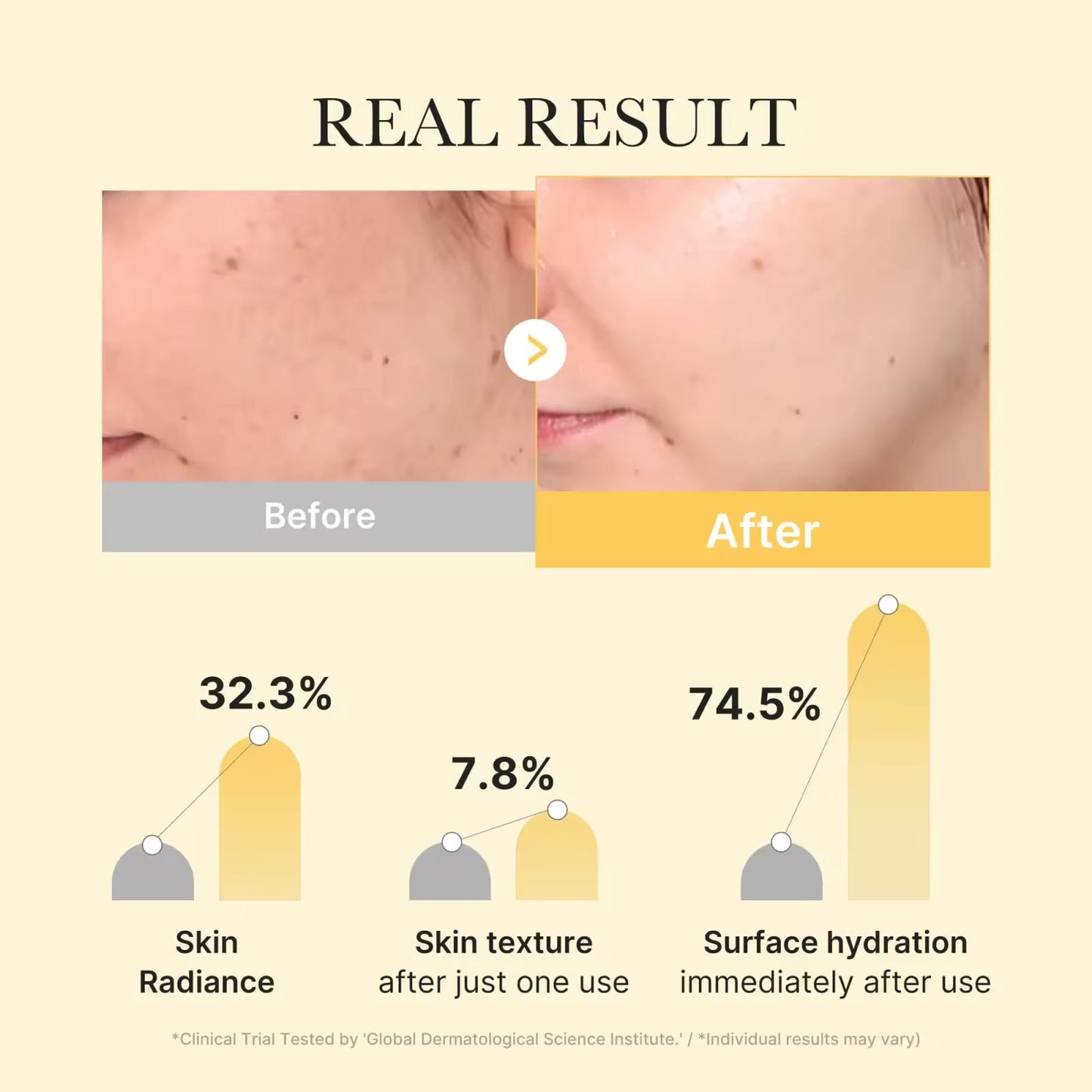 Kojic Acid + Turmeric Brightening Gel Mask – 4-Masks