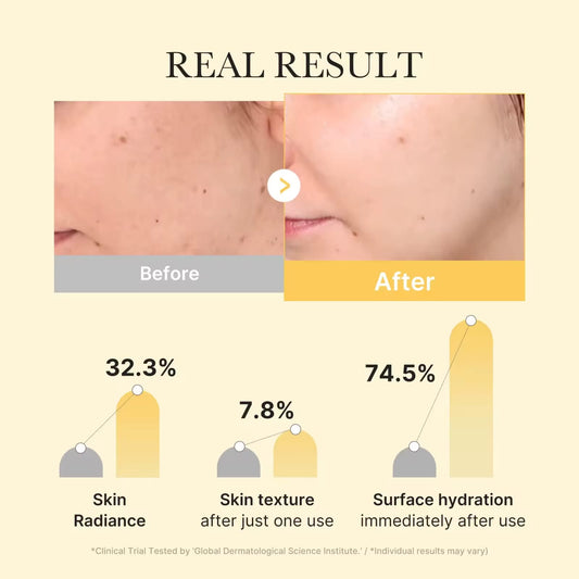 Kojic Acid + Turmeric Brightening Gel Mask – 4-Masks